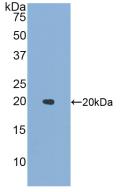 Active Interleukin 1 Family, Member 9 (IL1F9)