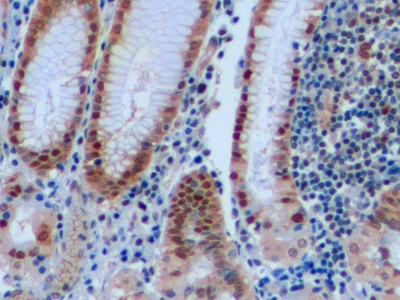 Anti-Proliferating Cell Nuclear Antigen (PCNA) Polyclonal Antibody