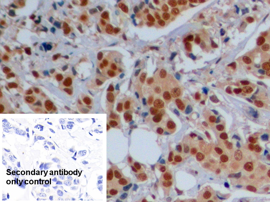 Anti-Proliferating Cell Nuclear Antigen (PCNA) Polyclonal Antibody