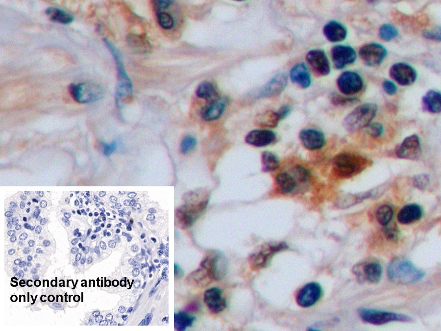 Anti-Proliferating Cell Nuclear Antigen (PCNA) Polyclonal Antibody