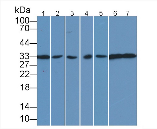 Anti-Proliferating Cell Nuclear Antigen (PCNA) Monoclonal Antibody