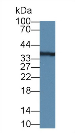 Anti-Proliferating Cell Nuclear Antigen (PCNA) Monoclonal Antibody