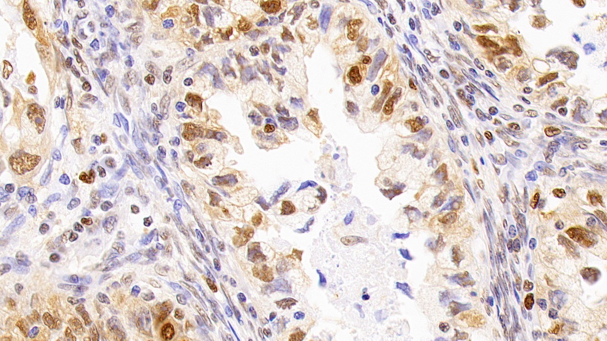 Anti-Proliferating Cell Nuclear Antigen (PCNA) Monoclonal Antibody