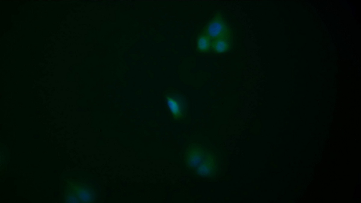 Anti-Proliferating Cell Nuclear Antigen (PCNA) Monoclonal Antibody