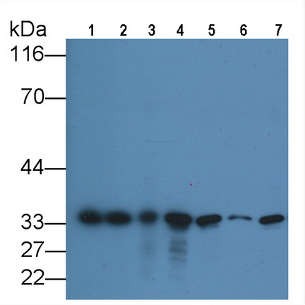 Anti-Proliferating Cell Nuclear Antigen (PCNA) Monoclonal Antibody