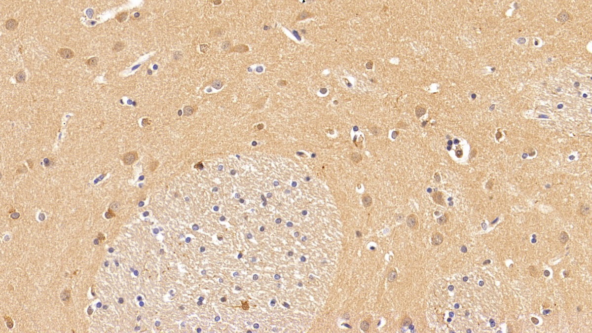 Anti-Beta Catenin (β-catenin) Polyclonal Antibody