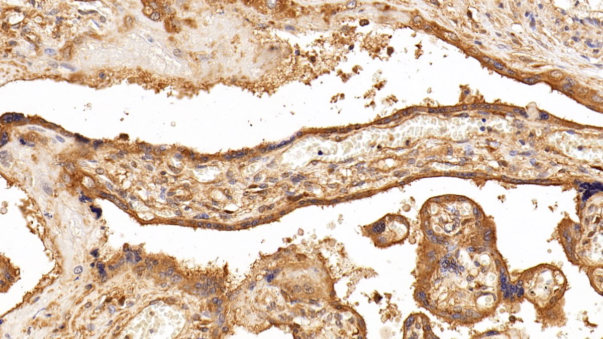 Anti-Beta Catenin (β-catenin) Polyclonal Antibody