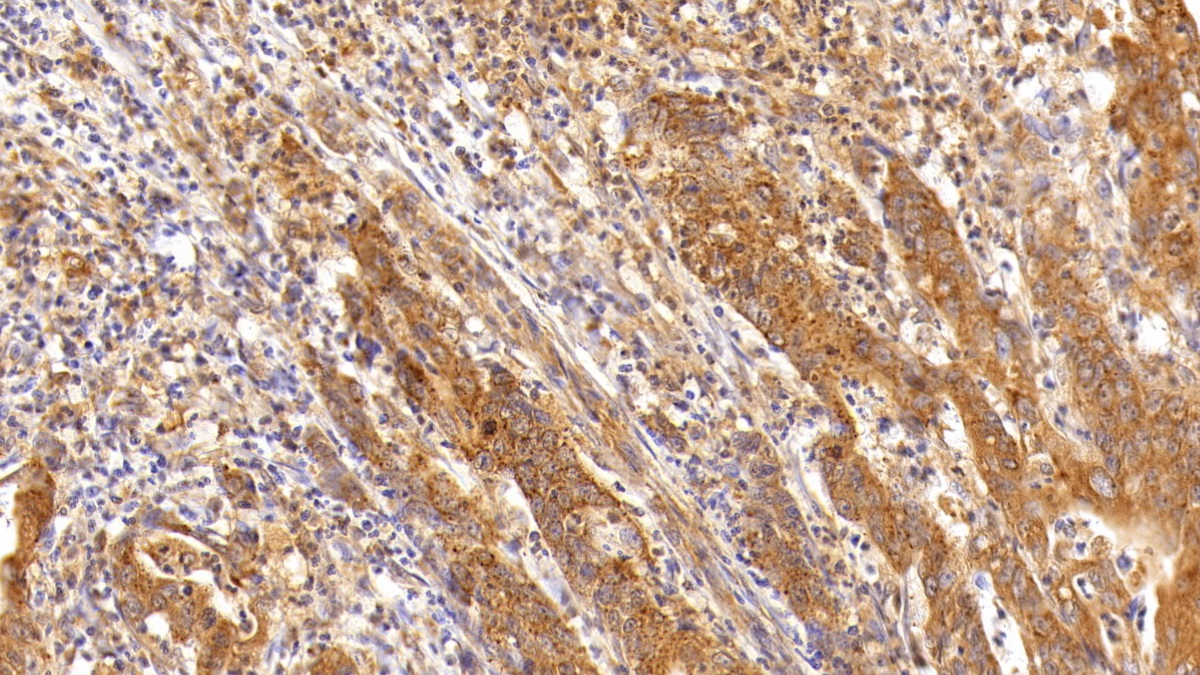 Anti-Beta Catenin (β-catenin) Polyclonal Antibody