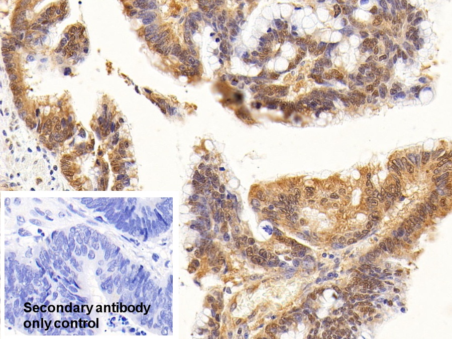 Anti-Beta Catenin (β-catenin) Polyclonal Antibody