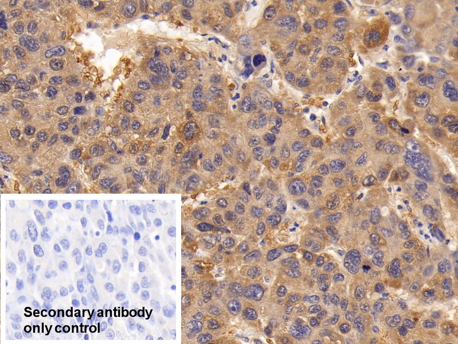 Anti-Beta Catenin (β-catenin) Polyclonal Antibody