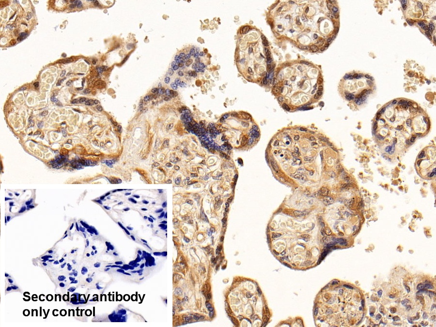 Anti-Beta Catenin (β-catenin) Polyclonal Antibody