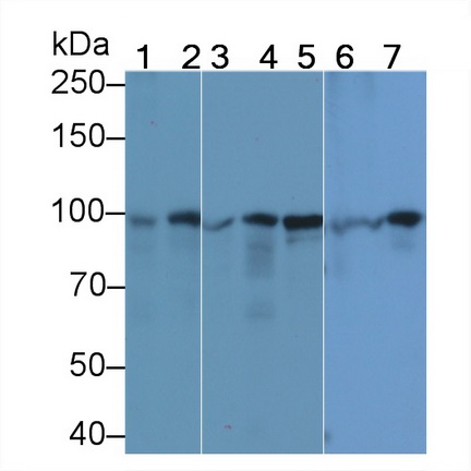 Anti-Beta Catenin (β-catenin) Monoclonal Antibody