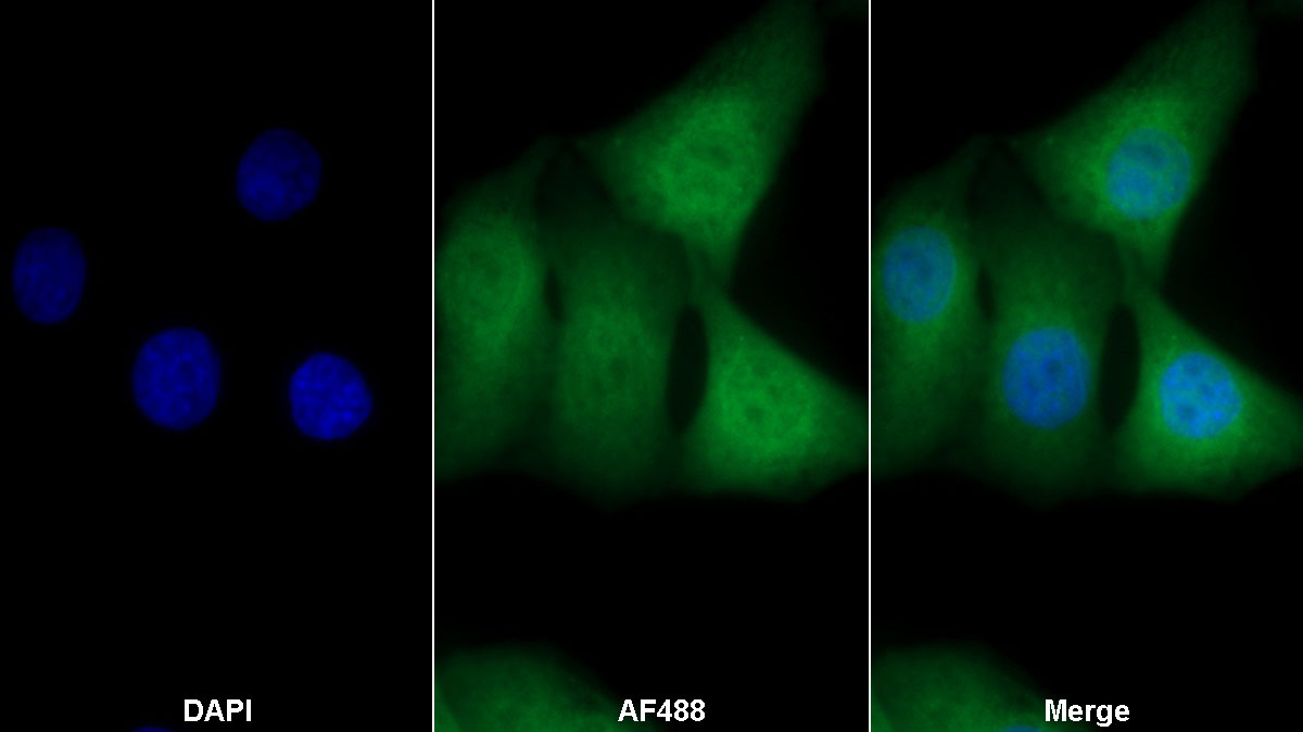 Anti-Heat Shock 70kDa Protein 1A (HSPA1A) Monoclonal Antibody