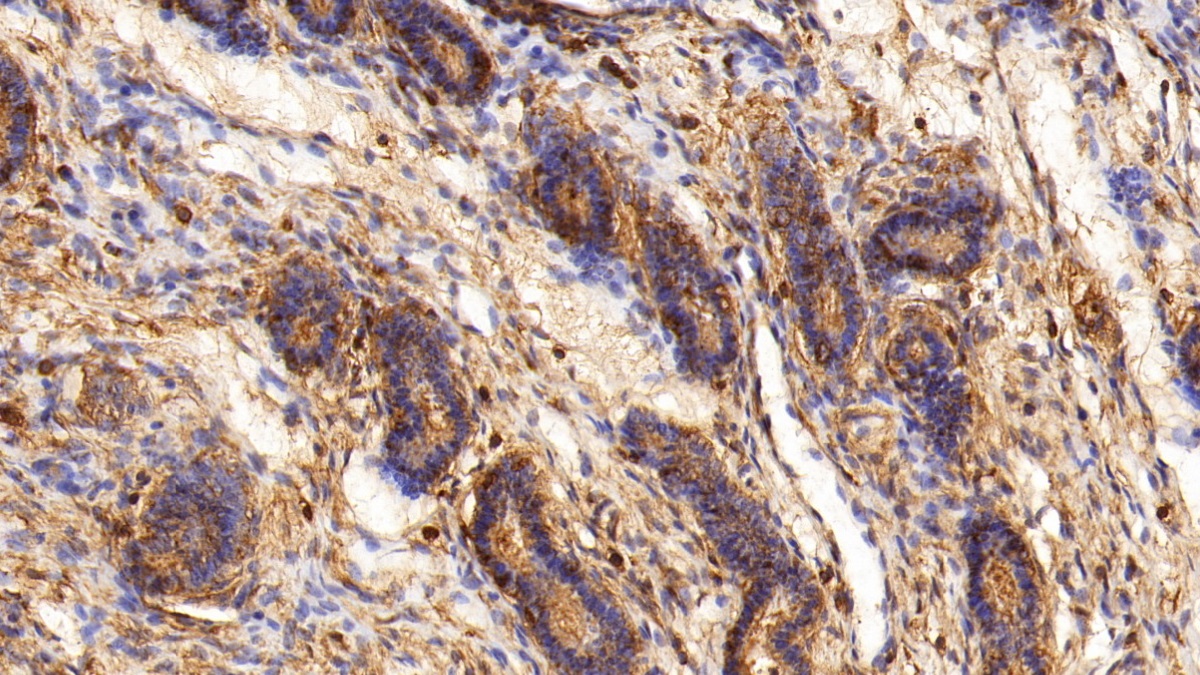 Anti-Beta Actin (ACTB) Polyclonal Antibody