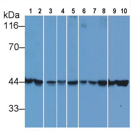 Anti-Beta Actin (ACTB) Monoclonal Antibody