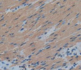 Anti-Actin Alpha 1, Cardiac Muscle (ACTC1) Polyclonal Antibody