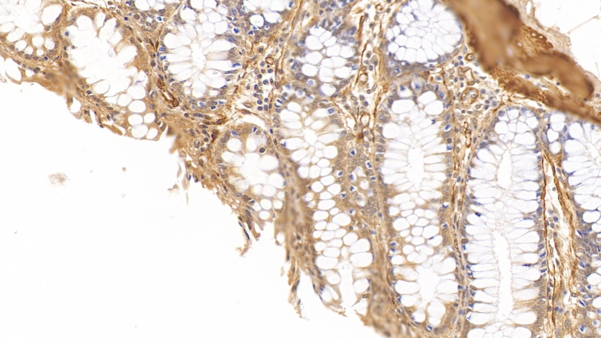 Anti-Actin Alpha 1, Cardiac Muscle (ACTC1) Monoclonal Antibody