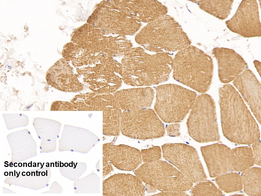 Anti-Actin Alpha 1, Cardiac Muscle (ACTC1) Monoclonal Antibody