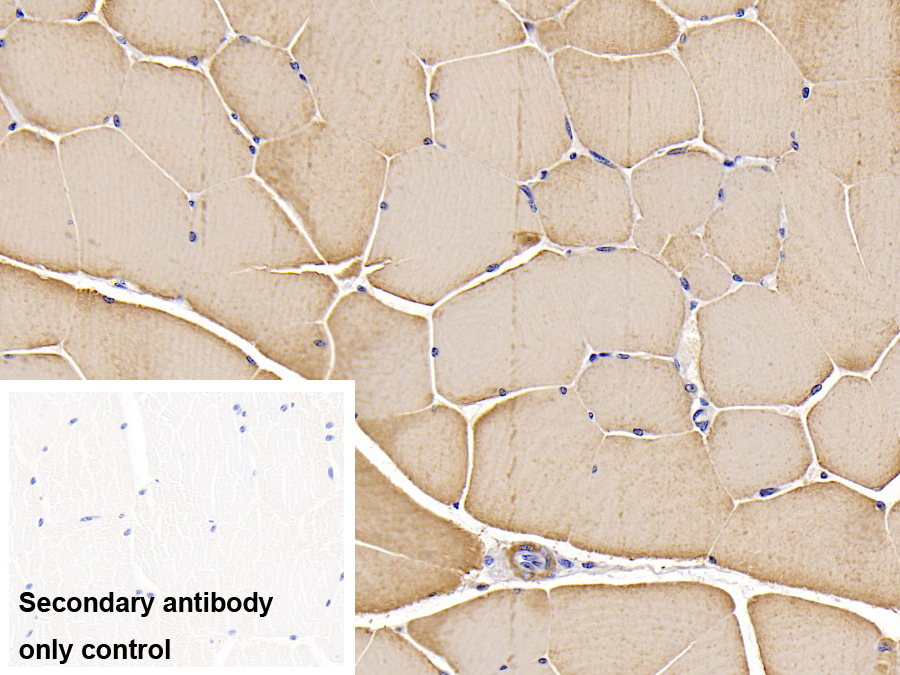 Anti-Actin Alpha 1, Cardiac Muscle (ACTC1) Monoclonal Antibody