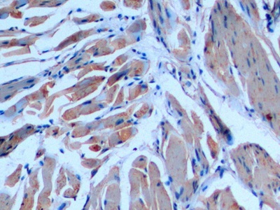 Anti-Actin Alpha 2, Smooth Muscle (ACTa2) Polyclonal Antibody