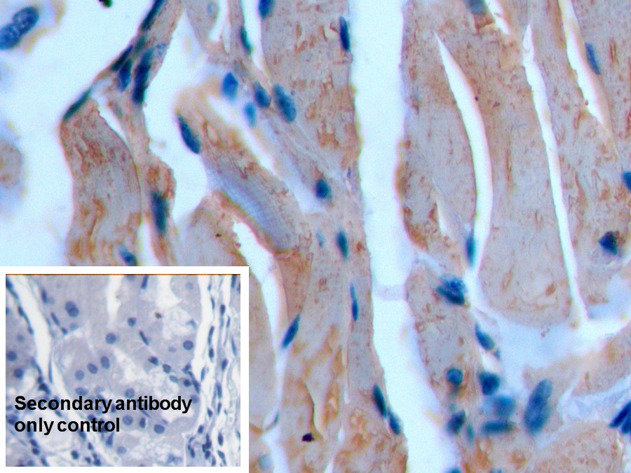 Anti-Actin Alpha 2, Smooth Muscle (ACTa2) Polyclonal Antibody