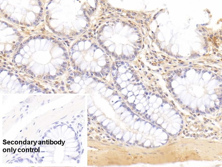 Anti-Actin Alpha 2, Smooth Muscle (ACTa2) Monoclonal Antibody