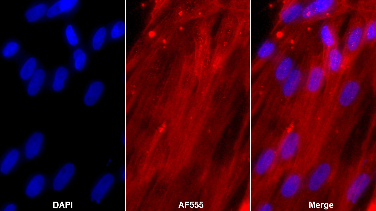 Anti-Actin Alpha 2, Smooth Muscle (ACTa2) Monoclonal Antibody