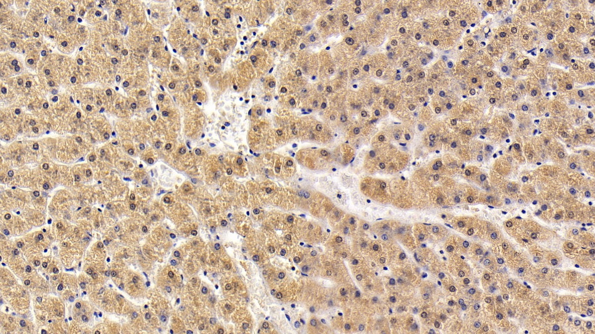 Anti-Extracellular Signal Regulated Kinase 1 (ERK1) Polyclonal Antibody