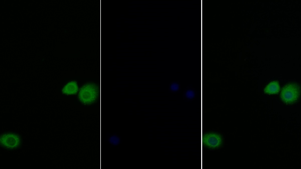 Anti-Extracellular Signal Regulated Kinase 1 (ERK1) Polyclonal Antibody