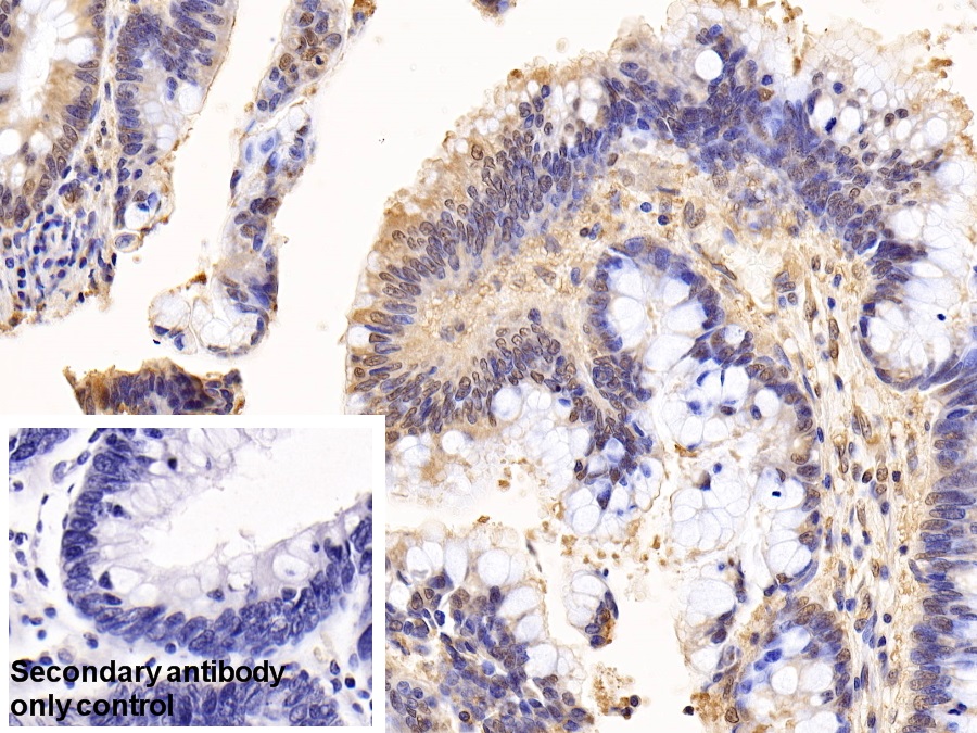 Anti-Extracellular Signal Regulated Kinase 1 (ERK1) Polyclonal Antibody