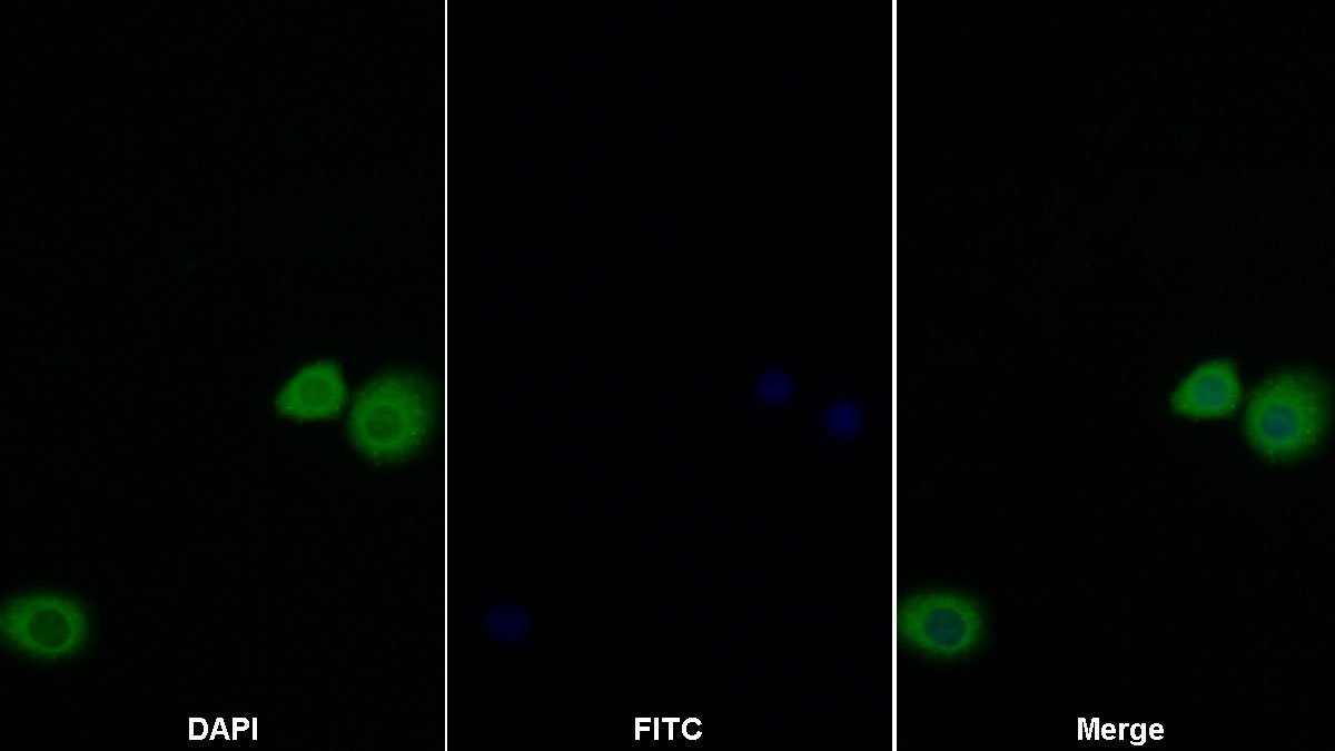 Anti-Extracellular Signal Regulated Kinase 1 (ERK1) Polyclonal Antibody