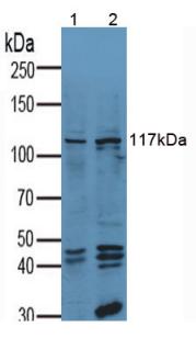 Anti-Vinculin (VCL) Polyclonal Antibody