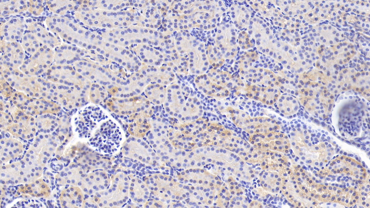 Anti-Vinculin (VCL) Polyclonal Antibody