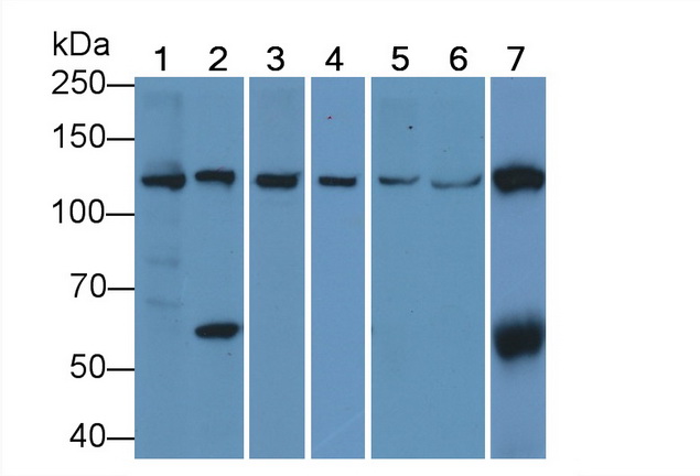 Anti-Vinculin (VCL) Monoclonal Antibody