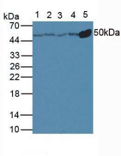 Anti-Tubulin Beta (TUBb) Polyclonal Antibody