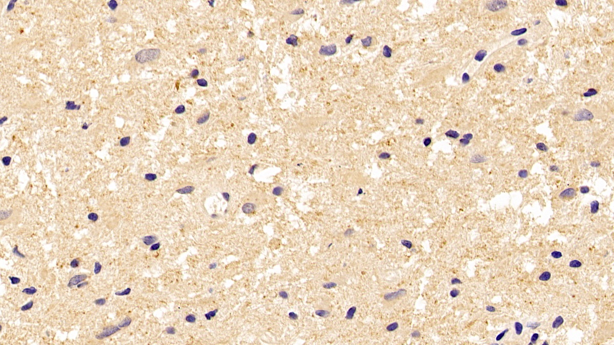 Anti-Tubulin Beta (TUBb) Monoclonal Antibody