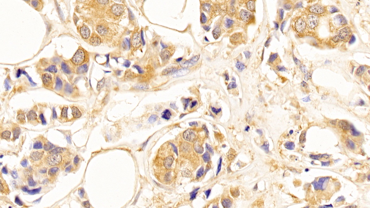 Anti-Tubulin Beta (TUBb) Monoclonal Antibody