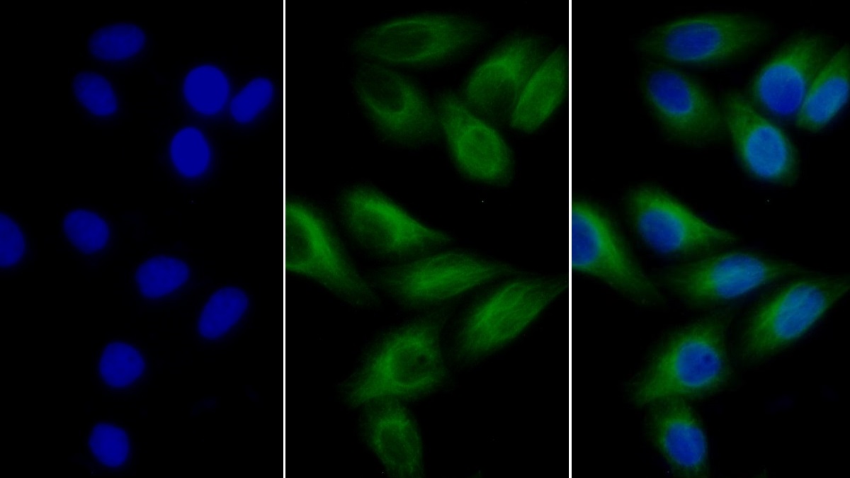 Anti-Tubulin Beta (TUBb) Monoclonal Antibody