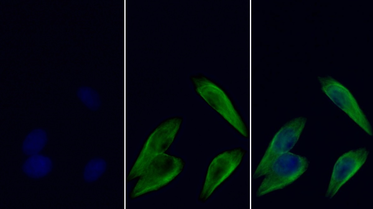 Anti-Tubulin Beta (TUBb) Monoclonal Antibody