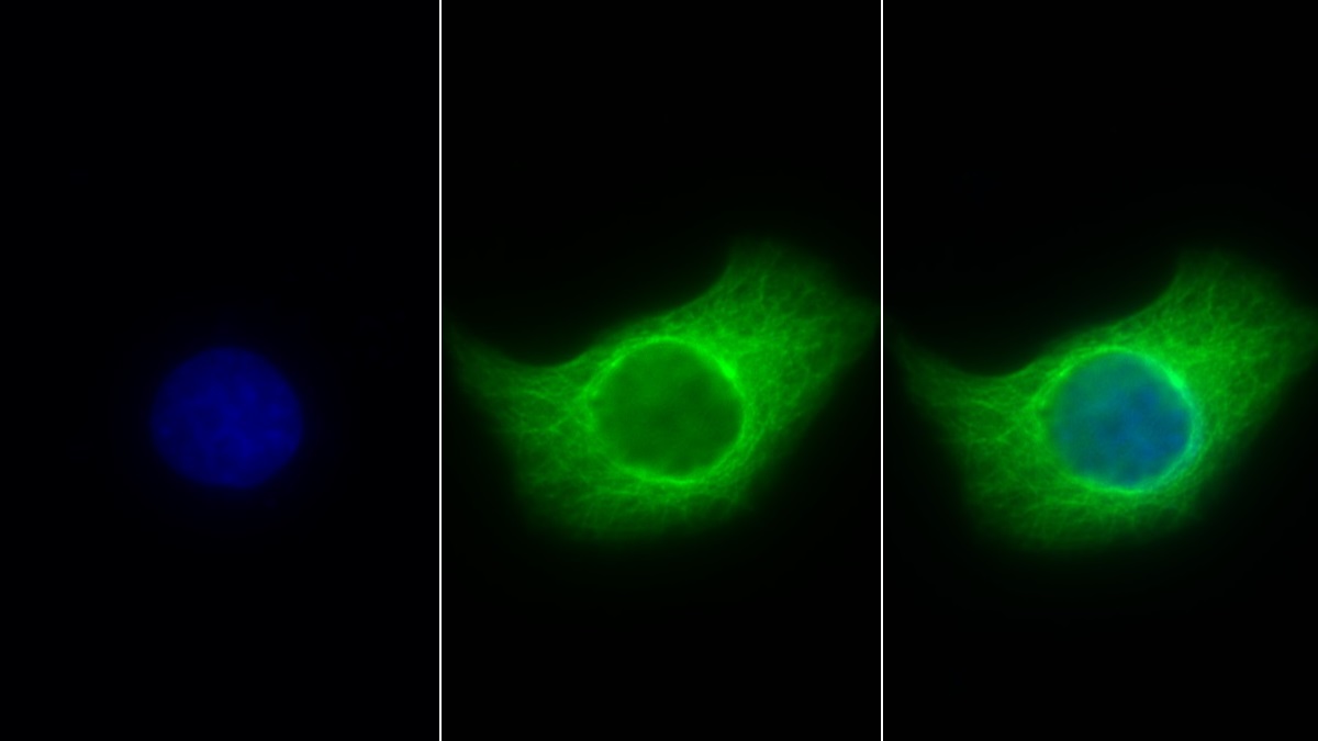 Anti-Tubulin Beta (TUBb) Monoclonal Antibody