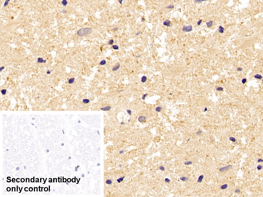 Anti-Tubulin Beta (TUBb) Monoclonal Antibody