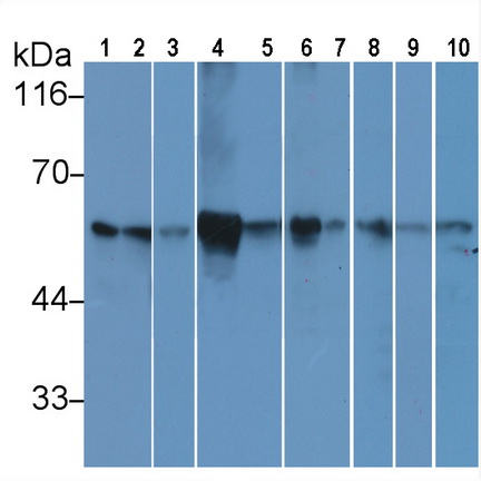 Anti-Tubulin Beta (TUBb) Monoclonal Antibody