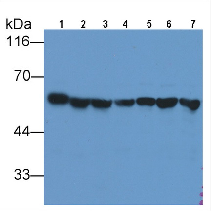 Anti-Tubulin Beta (TUBb) Monoclonal Antibody