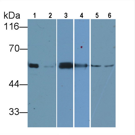 Anti-Tubulin Beta (TUBb) Monoclonal Antibody