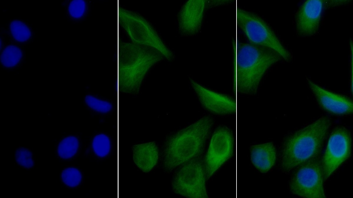 Anti-Tubulin Beta (TUBb) Monoclonal Antibody