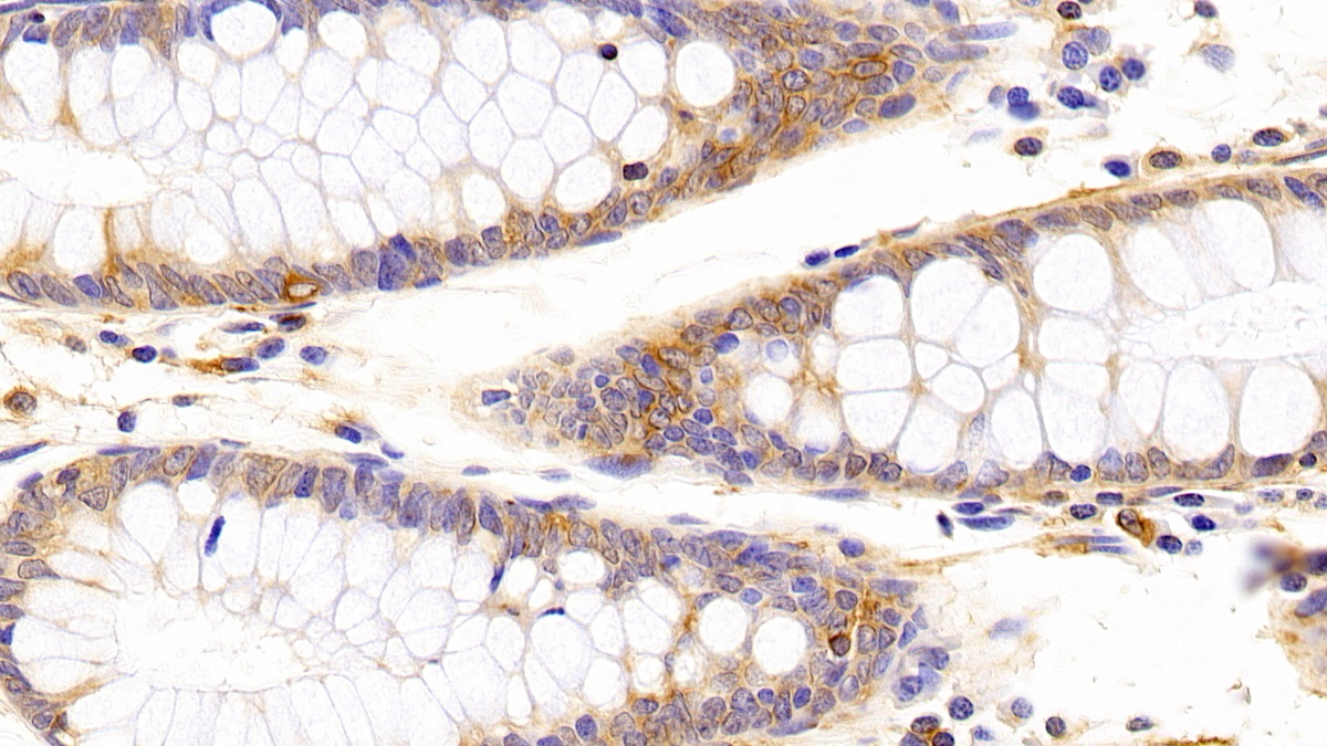 Anti-Tubulin Beta (TUBb) Monoclonal Antibody