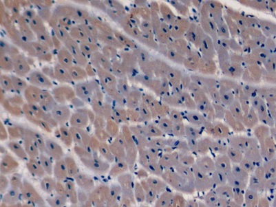 Anti-Tubulin Beta (TUBb) Monoclonal Antibody