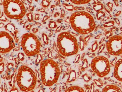 Anti-Tubulin Beta (TUBb) Monoclonal Antibody