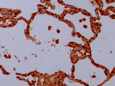 Anti-Tubulin Beta (TUBb) Monoclonal Antibody