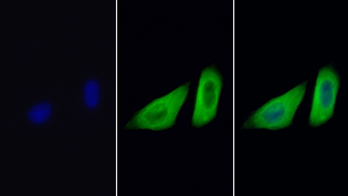 Anti-Tubulin Beta (TUBb) Monoclonal Antibody